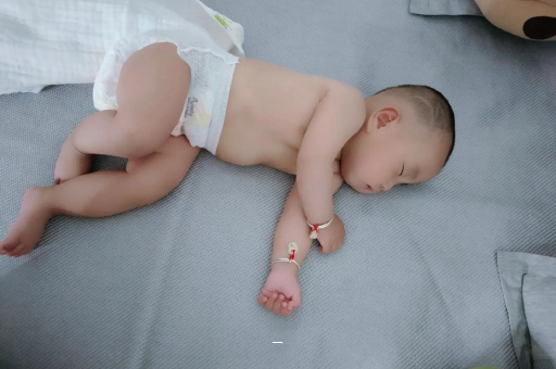 邵阳县宝宝脸上有白色斑块